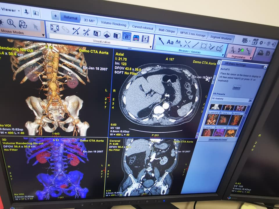 Soft de inteligență artificială pentru tratarea cancerului