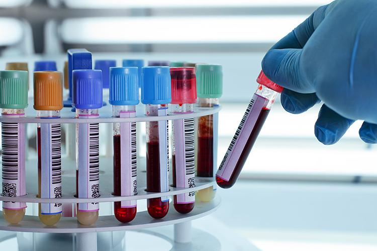 Peste 11.600 de români au fost confirmaţi cu COVID-19