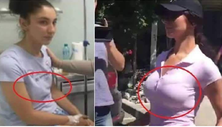 Printre beneficiile bătăii, mărirea de sâni