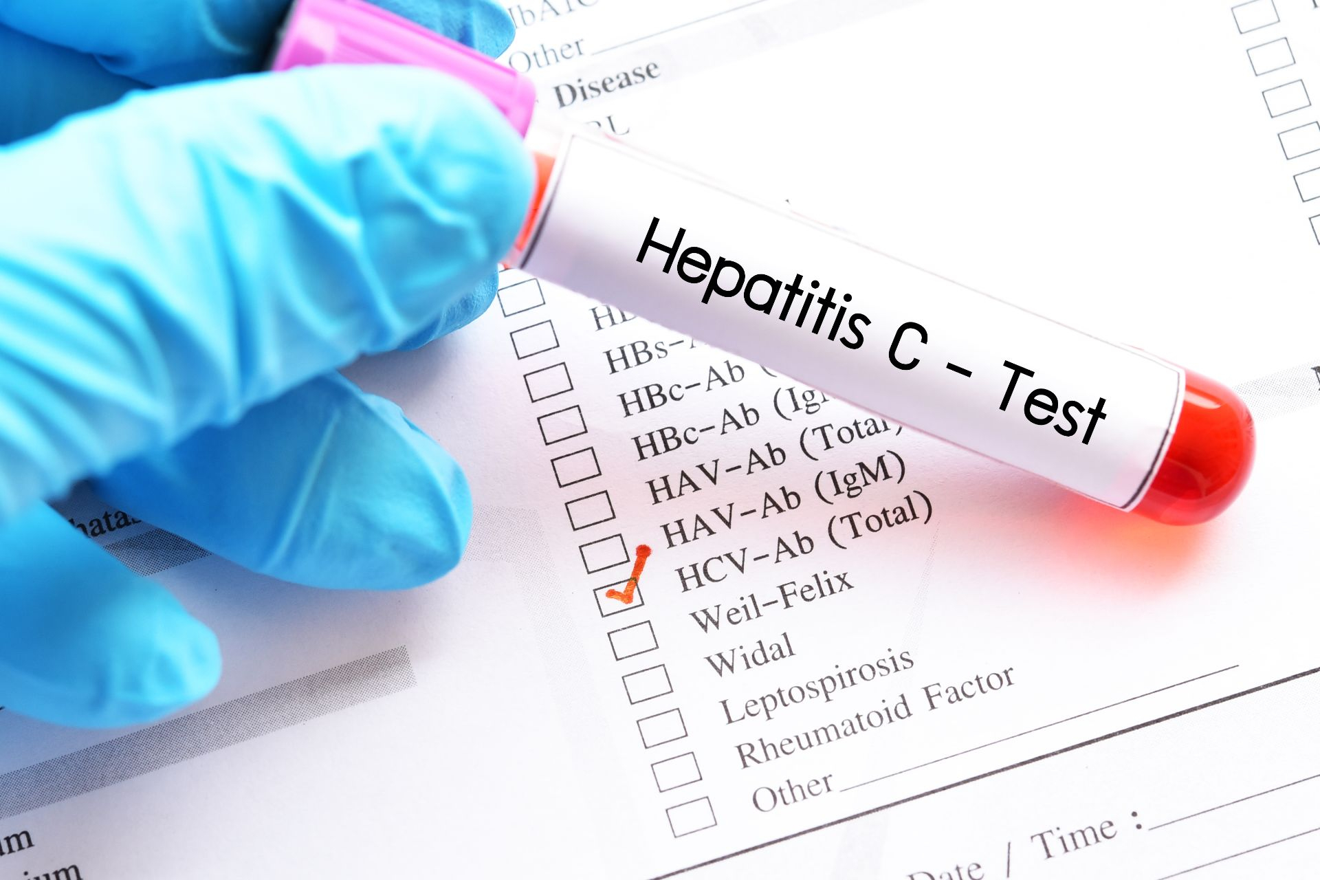 Testare gratuită pentru hepatita B și C